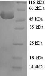 Recombinant Human Corticosteroid-binding globulin (SERPINA6)