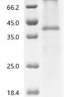 (Tris-Glycine gel) Discontinuous SDS-PAGE (reduced) with 5% enrichment gel and 15% separation gel.