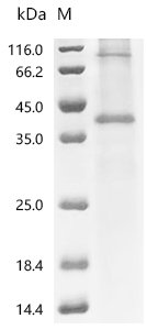 (Tris-Glycine gel) Discontinuous SDS-PAGE (reduced) with 5% enrichment gel and 15% separation gel.