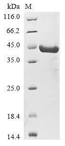 Recombinant Human Sestrin-3 (SESN3), Homo sapiens (Human), E.coli, N-terminal 10xHis-tagged and C-terminal Myc-tagged, 44.1kDa, purity >85% as determined by SDS-PAGE.