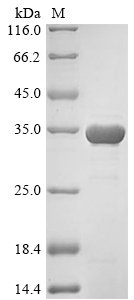 Recombinant Human 14-3-3 protein sigma (SFN)