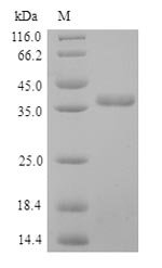Recombinant Human Pulmonary surfactant-associated protein D (SFTPD), Homo sapiens (Human), Yeast, N-terminal 6xHis-tagged, 35.2kDa, purity >90% as determined by SDS-PAGE.