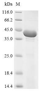 Recombinant Human Small glutamine-rich tetratricopeptide repeat-containing protein beta (SGTB)