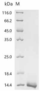 Recombinant Human Single Ig IL-1-related receptor(SIGIRR), partial, Homo sapiens (Human), Yeast, N-terminal 6xHis-tagged, 14.6kDa, purity >95% as determined by SDS-PAGE.