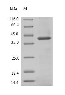 Recombinant Human Signal-regulatory protein beta-1 (SIRPB1), partial