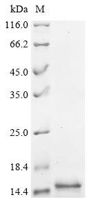 Recombinant Human Thiamine transporter 2 (SLC19A3), partial, Homo sapiens (Human), E.coli, N-terminal 6xHis-tagged, 11.4kDa, purity >90% as determined by SDS-PAGE.