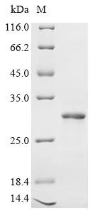 Recombinant Human Zinc transporter 10 (SLC30A10), partial, Homo sapiens (Human), E.coli, N-terminal 10xHis-tagged and C-terminal Myc-tagged, 27.9kDa, purity >90% as determined by SDS-PAGE.