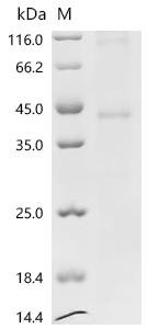 Recombinant Rat 5-hydroxytryptamine receptor 1B (Htr1b) Protein, Rattus norvegicus (Rat), in vitro E.coli expression system, N-terminal 10xHis-tagged, 44.7kDa, purity >95% as determined by SDS-PAGE.