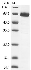 Recombinant Human Mothers against decapentaplegic homolog 6 (SMAD6)