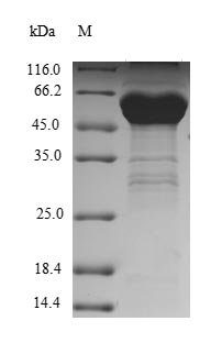 Recombinant Human Transcription activator BRG1 (SMARCA4), partial