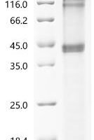 (Tris-Glycine gel) Discontinuous SDS-PAGE (reduced) with 5% enrichment gel and 15% separation gel.
