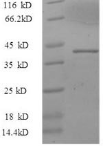 Recombinant Human Alpha-synuclein (SNCA), partial, Homo sapiens (Human), E.coli, N-terminal GST-tagged, 41.4kDa, purity >90% as determined by SDS-PAGE.