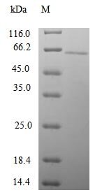 Recombinant Human Gamma-1-syntrophin (SNTG1), Homo sapiens (Human), E.coli, N-terminal 10xHis-tagged and C-terminal Myc-tagged, 63.0kDa, purity >90% as determined by SDS-PAGE.
