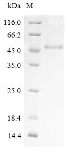 Recombinant Human Sorting nexin-16 (SNX16)