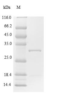 Recombinant Human Suppressor of cytokine signaling 1 (SOCS1)