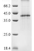 (Tris-Glycine gel) Discontinuous SDS-PAGE (reduced) with 5% enrichment gel and 15% separation gel.