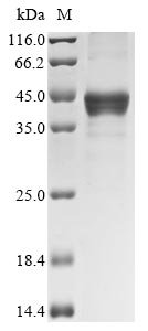 Recombinant Human Transcription factor SOX-2 (SOX2) (M317MC)