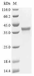 Recombinant Human Spastin (SPAST), partial, Homo sapiens (Human), E.coli, N-terminal 6xHis-tagged, 40.1kDa, purity >85% as determined by SDS-PAGE.