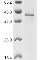 (Tris-Glycine gel) Discontinuous SDS-PAGE (reduced) with 5% enrichment gel and 15% separation gel.