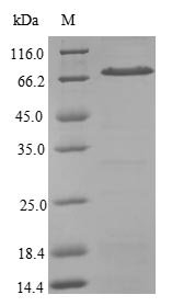 Recombinant Human Signal recognition particle subunit SRP54 (SRP54), Homo sapiens (Human), E.coli, N-terminal 6xHis-B2M-tagged, 69.7kDa, purity >90% as determined by SDS-PAGE.