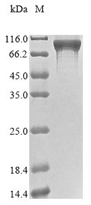 Recombinant Human Signal recognition particle subunit SRP72 (SRP72), Homo sapiens (Human), E.coli, N-terminal GST-tagged, 101.1kDa, purity >85% as determined by SDS-PAGE.