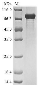 Recombinant Human Serine/arginine repetitive matrix protein 2 (SRRM2), partial, Homo sapiens (Human), Baculovirus, N-terminal 10xHis-tagged and C-terminal Myc-tagged, 53.8kDa, purity >85% as determined by SDS-PAGE.