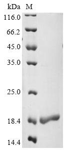 Recombinant Human Serine/arginine-rich splicing factor 3 (SRSF3), partial