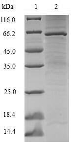 Recombinant Human Lupus La protein (SSB)