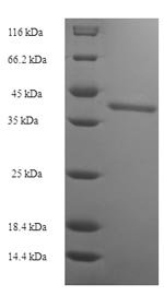 Recombinant Human Protein SSX2 (SSX2)