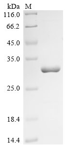 Recombinant Human Protein SSX4 (SSX4)