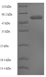 Recombinant Human CMP-N-acetylneuraminate-beta-1,4-galactoside alpha-2,3-sialyltransferase (ST3GAL3), partial, Homo sapiens (Human), E.coli, N-terminal 6xHis-SUMO-tagged, 54.9kDa, purity >90% as determined by SDS-PAGE.