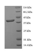 Recombinant Human Signal transducer and activator of transcription 3 (STAT3), partial, Homo sapiens (Human), E.coli, N-terminal 6xHis-SUMO-tagged, 38.3kDa, purity >90% as determined by SDS-PAGE.