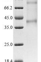 (Tris-Glycine gel) Discontinuous SDS-PAGE (reduced) with 5% enrichment gel and 15% separation gel.