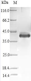 Recombinant Human Stanniocalcin-1 (STC1), partial, Homo sapiens (Human), E.coli, N-terminal 6xHis-SUMO-tagged, 39.6kDa, purity >90% as determined by SDS-PAGE.
