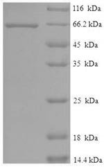 Recombinant Human Serine/threonine-protein kinase STK11 (STK11)