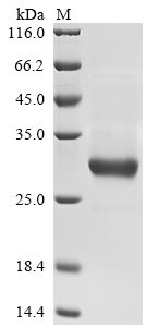 Recombinant Human Stimulated by retinoic acid gene 6 protein homolog (STRA6), partial, Homo sapiens (Human), Yeast, C-terminal hFc1-tagged, 33.4kDa, purity >90% as determined by SDS-PAGE.