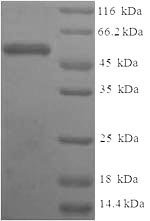 Recombinant Human Sulfotransferase 1A3 (SULT1A3)