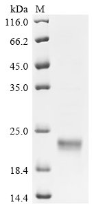 Recombinant Human Sushi, von Willebrand factor type A, EGF and pentraxin domain-containing protein 1 (SVEP1), partial, Homo sapiens (Human), E.coli, C-terminal 6xHis-tagged, 17.6kDa, purity >95% as determined by SDS-PAGE.