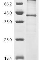 (Tris-Glycine gel) Discontinuous SDS-PAGE (reduced) with 5% enrichment gel and 15% separation gel.
