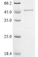 (Tris-Glycine gel) Discontinuous SDS-PAGE (reduced) with 5% enrichment gel and 15% separation gel.