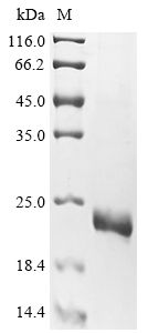 Recombinant Human TAR DNA-binding protein 43 (TARDBP), partial