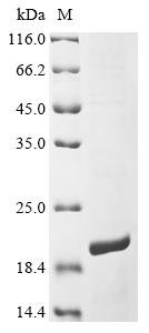 Recombinant Human Taste receptor type 2 member 10 (TAS2R10), partial, Homo sapiens (Human), E.coli, N-terminal 6xHis-KSI-tagged, 19.6kDa, purity >90% as determined by SDS-PAGE.