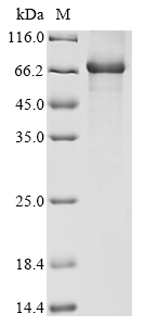 Recombinant Human T-box transcription factor TBX5 (TBX5), Homo sapiens (Human), E.coli, N-terminal 10xHis-tagged and C-terminal Myc-tagged, 65.2kDa, purity >85% as determined by SDS-PAGE.
