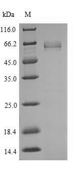 Recombinant Human Transcription factor 7-like 2 (TCF7L2), partial