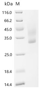 Recombinant Human Transcriptional enhancer factor TEF-1 (TEAD1), partial, Homo sapiens (Human), Yeast, N-terminal 6xHis-tagged, 26.6kDa, purity >95% as determined by SDS-PAGE.