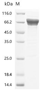 Recombinant Human Terminal nucleotidyltransferase 4B (TENT4B), Homo sapiens (Human), E.coli, N-terminal 6xHis-tagged, 67.3kDa, purity >85% as determined by SDS-PAGE.