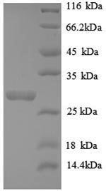 Recombinant Human Telomerase protein component 1 (TEP1), partial, Homo sapiens (Human), E.coli, N-terminal 6xHis-tagged, 28.8kDa, purity >90% as determined by SDS-PAGE.