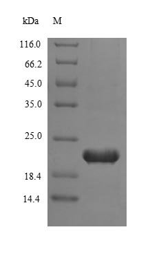 Recombinant Human Telomerase reverse transcriptase (TERT), partial, Homo sapiens (Human), E.coli, N-terminal 6xHis-tagged, 22.7kDa, purity >85% as determined by SDS-PAGE.