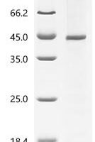 (Tris-Glycine gel) Discontinuous SDS-PAGE (reduced) with 5% enrichment gel and 15% separation gel.