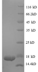 Recombinant Human Transforming growth factor beta-1 proprotein (TGFB1), partial, Homo sapiens (Human), E.coli, N-terminal 6xHis-tagged, 16.6kDa, purity >90% as determined by SDS-PAGE.